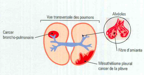 Vue transversale des poumons