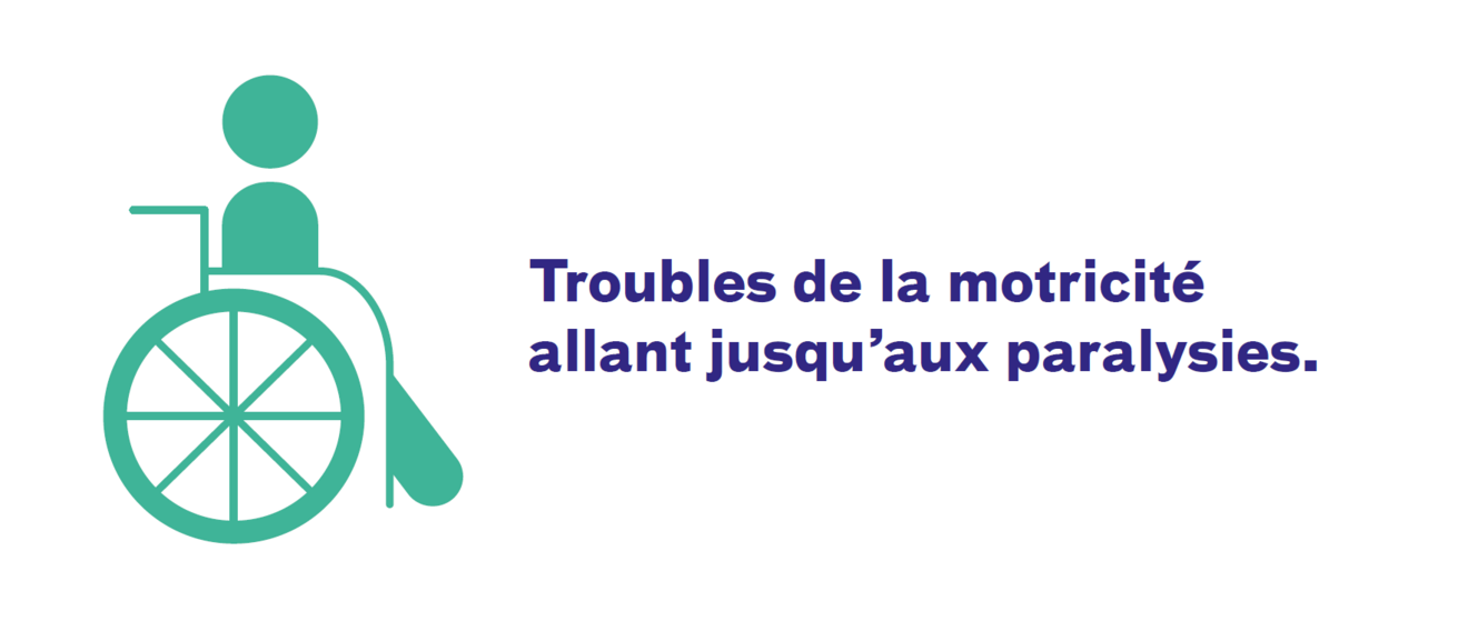 risques trouble motricité